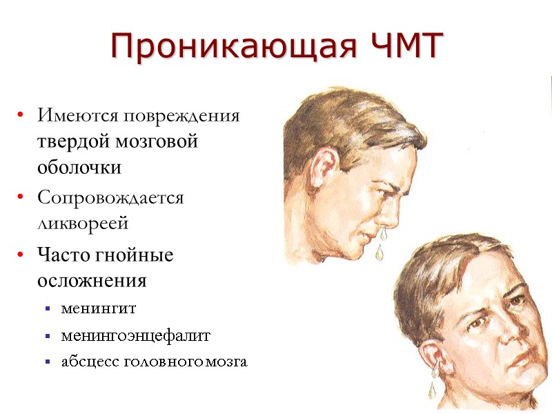 Проникающая ЧМТ Имеются повреждения твердой мозговой оболочки Сопровождается ликвореей Часто гнойные осложнения менингит менингоэнцефалит